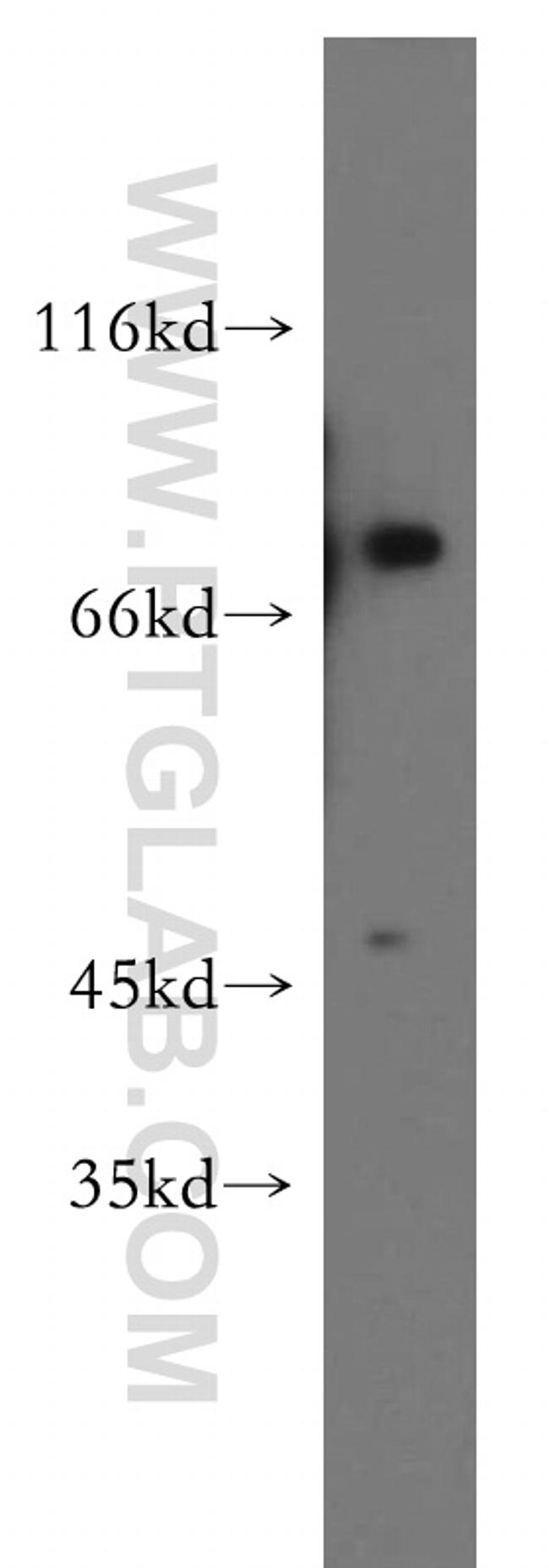 DDX51 Antibody in Western Blot (WB)