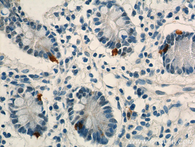 LGR4 Antibody in Immunohistochemistry (Paraffin) (IHC (P))