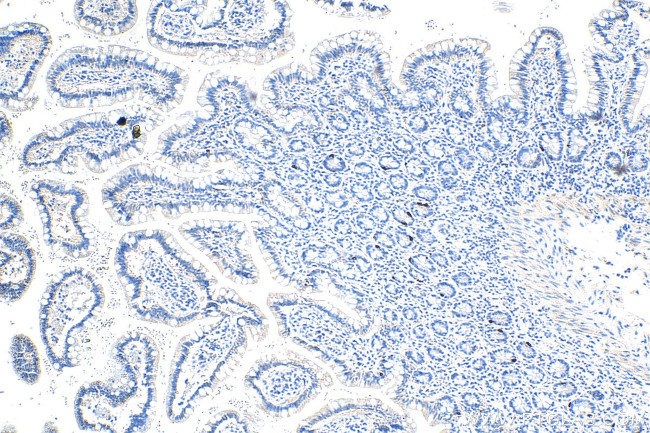 LGR4 Antibody in Immunohistochemistry (Paraffin) (IHC (P))