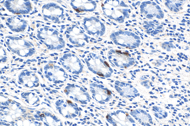 LGR4 Antibody in Immunohistochemistry (Paraffin) (IHC (P))