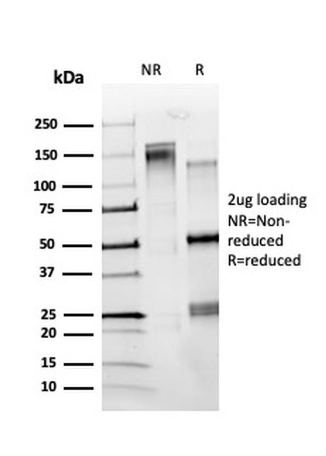 ZBTB7C/KR-POK Antibody in SDS-PAGE (SDS-PAGE)