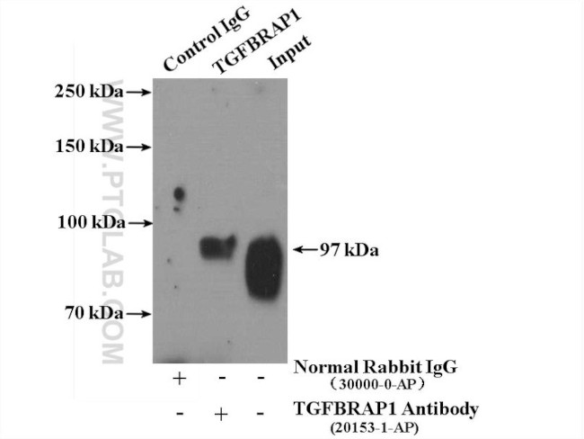 TGFBRAP1 Antibody in Immunoprecipitation (IP)