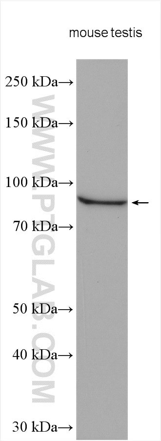 TGFBRAP1 Antibody in Western Blot (WB)