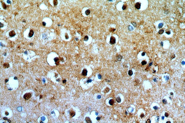 KLHL29 Antibody in Immunohistochemistry (Paraffin) (IHC (P))