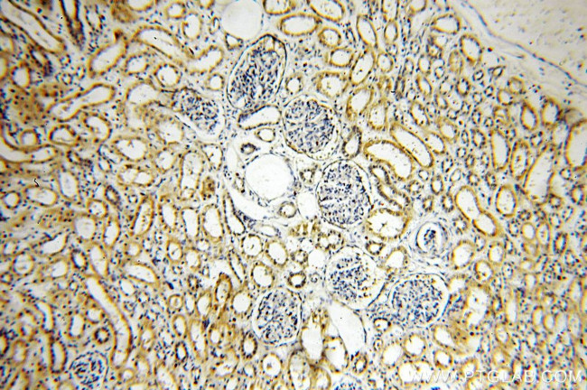 KLHL29 Antibody in Immunohistochemistry (Paraffin) (IHC (P))