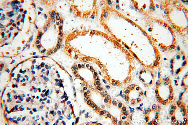 KLHL29 Antibody in Immunohistochemistry (Paraffin) (IHC (P))