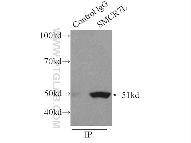 SMCR7L/MID51 Antibody in Immunoprecipitation (IP)