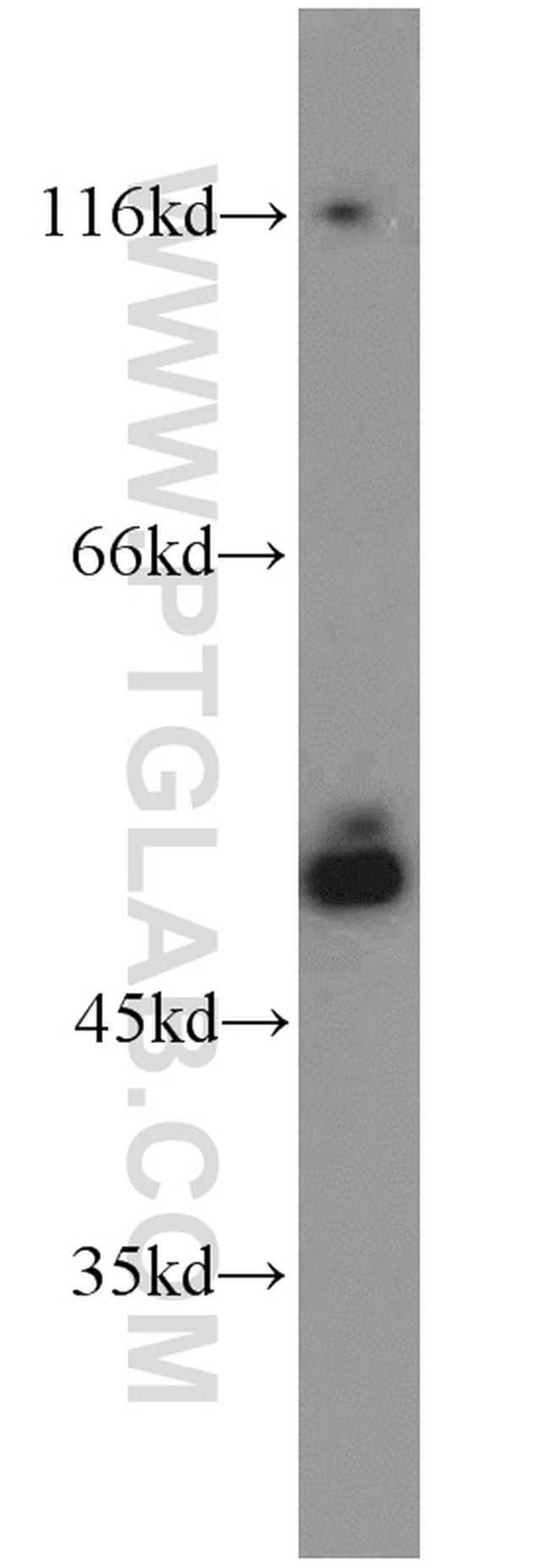 SMCR7L/MID51 Antibody in Western Blot (WB)