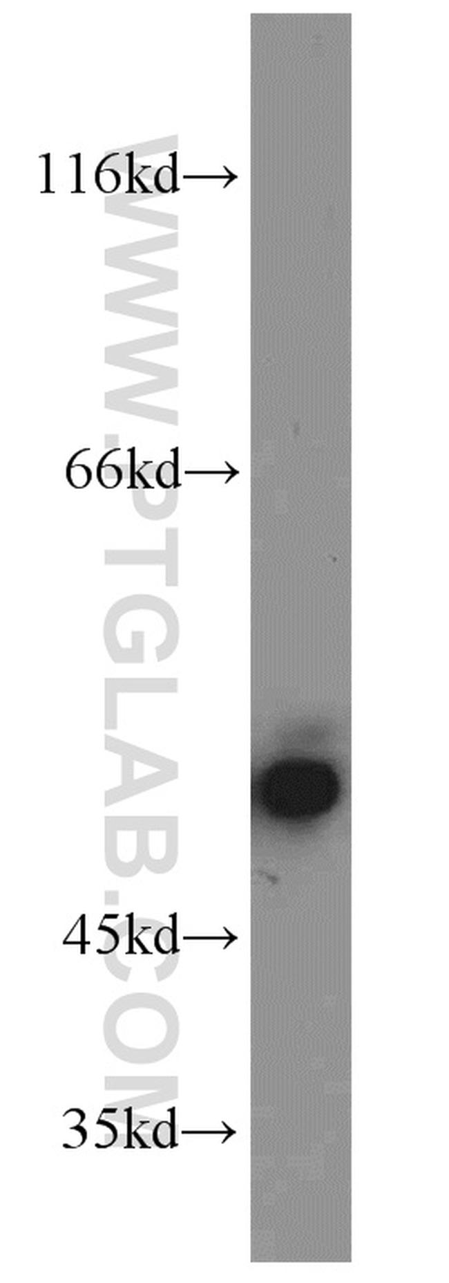 SMCR7L/MID51 Antibody in Western Blot (WB)