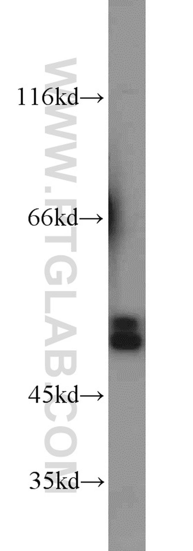 SMCR7L/MID51 Antibody in Western Blot (WB)