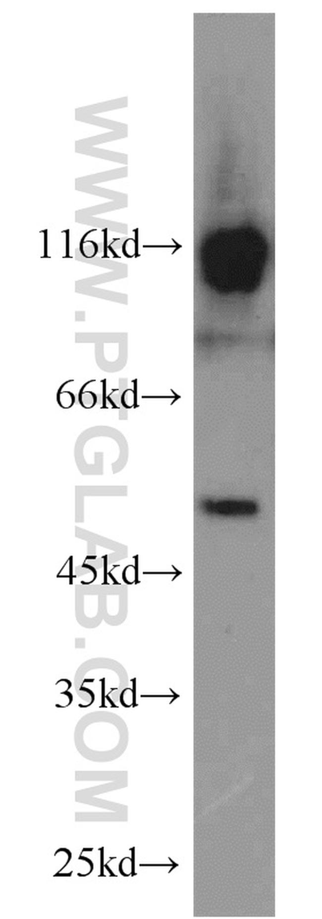 SMCR7L/MID51 Antibody in Western Blot (WB)