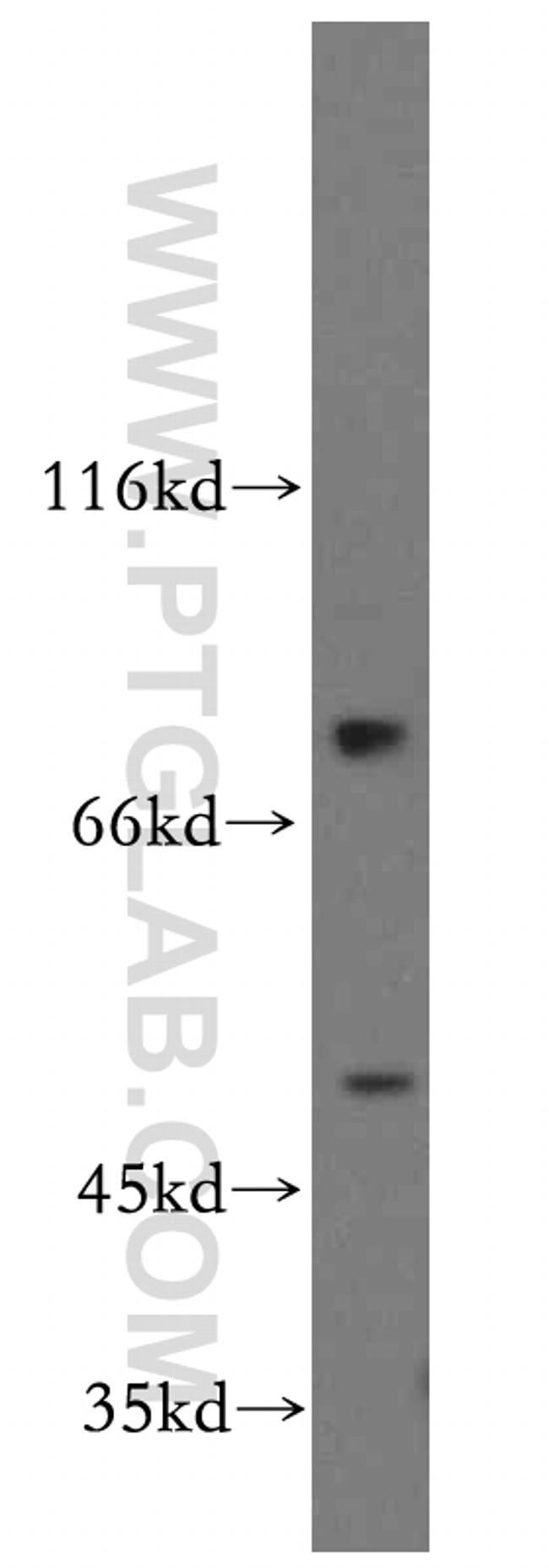 SMCR7L/MID51 Antibody in Western Blot (WB)