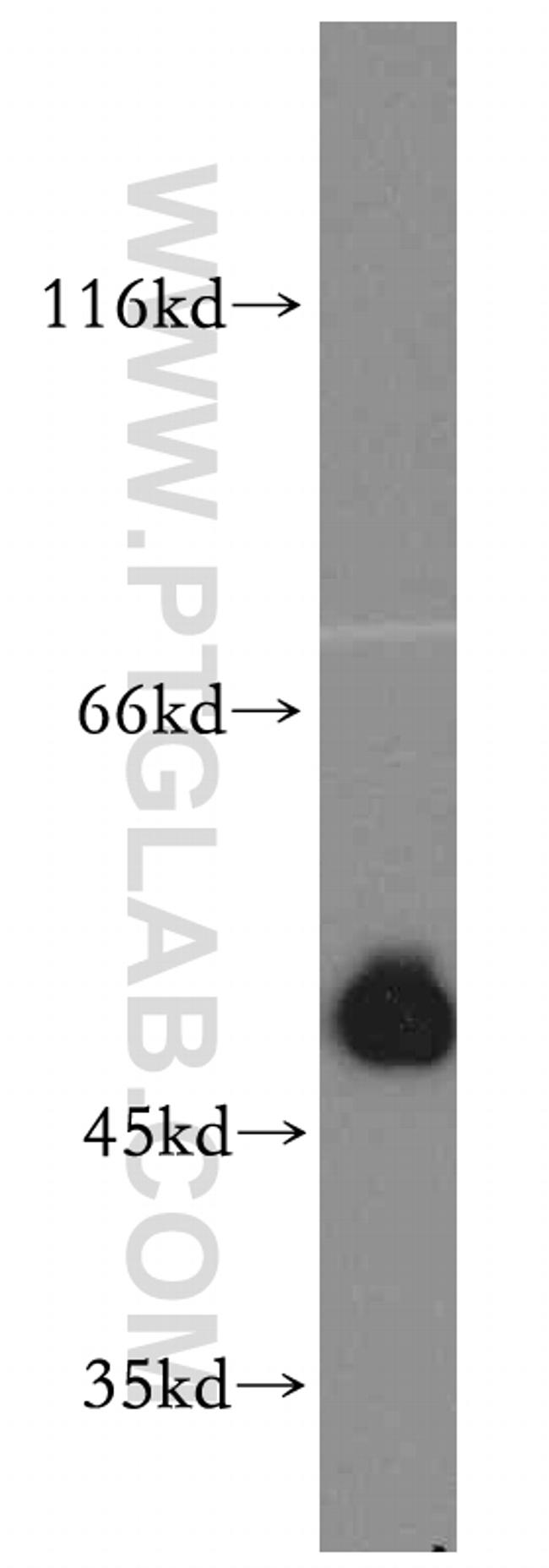 SMCR7L/MID51 Antibody in Western Blot (WB)