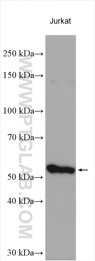 KATNAL1 Antibody in Western Blot (WB)