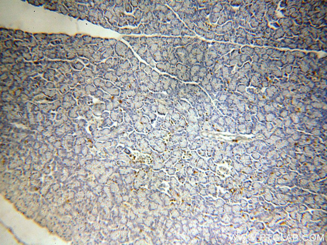 SLC25A23 Antibody in Immunohistochemistry (Paraffin) (IHC (P))