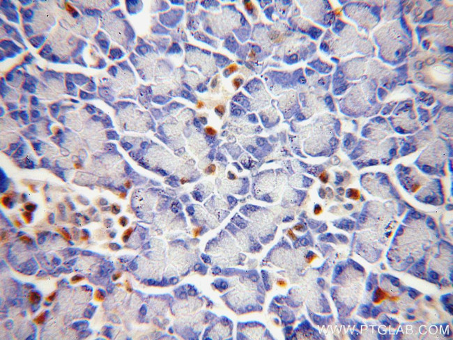 SLC25A23 Antibody in Immunohistochemistry (Paraffin) (IHC (P))