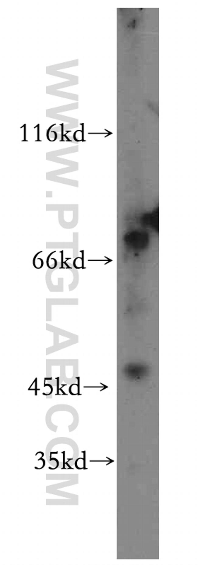 SLC25A23 Antibody in Western Blot (WB)