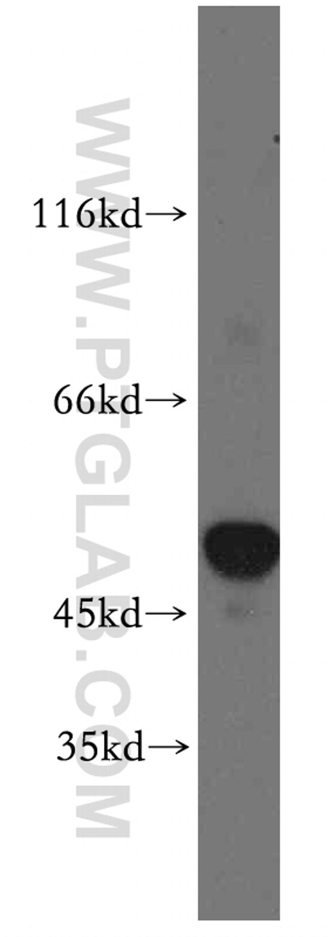 SLC25A23 Antibody in Western Blot (WB)