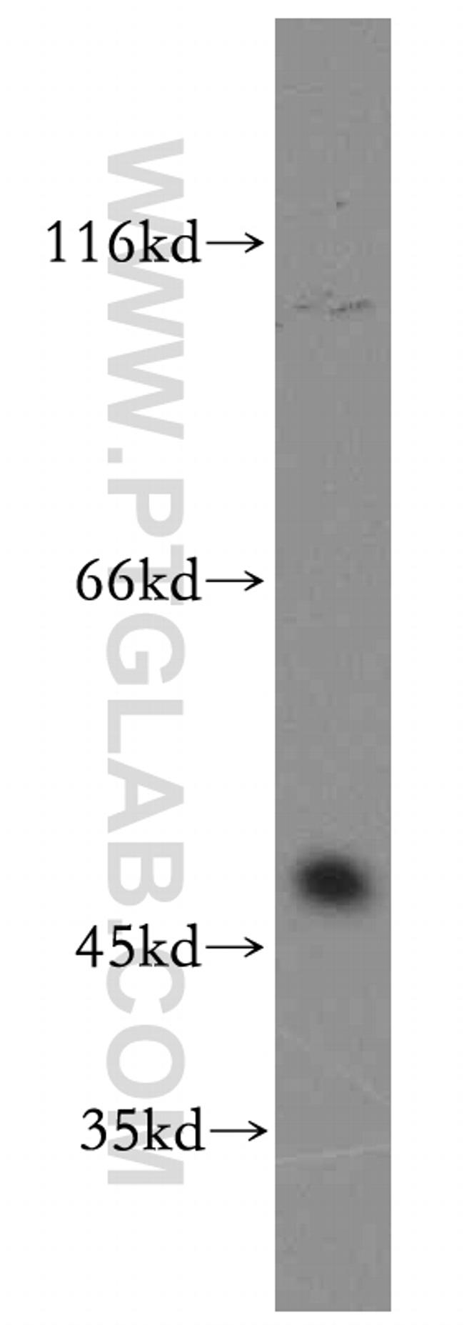 SLC25A23 Antibody in Western Blot (WB)