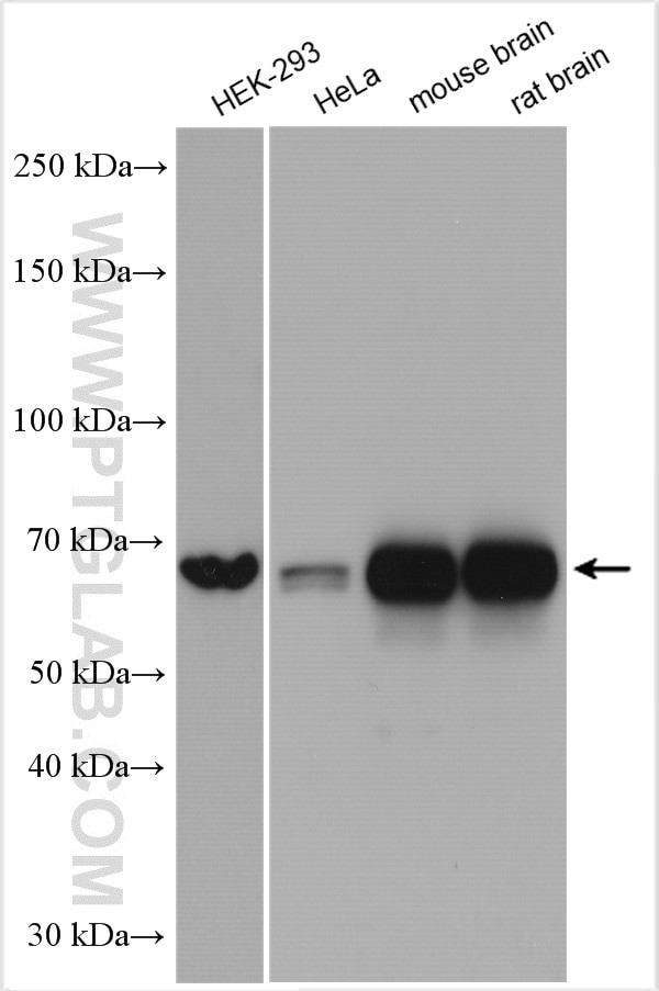 KGA Antibody in Western Blot (WB)