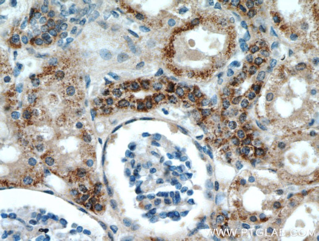 KGA Antibody in Immunohistochemistry (Paraffin) (IHC (P))