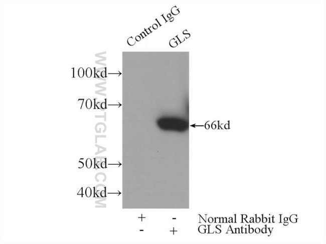 KGA Antibody in Immunoprecipitation (IP)