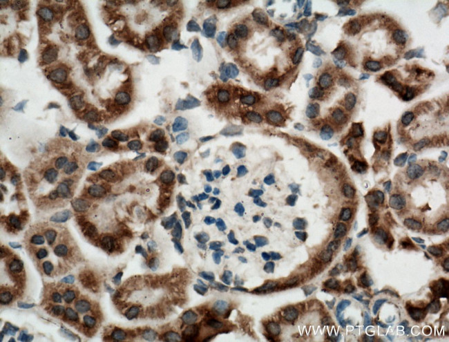 KGA Antibody in Immunohistochemistry (Paraffin) (IHC (P))