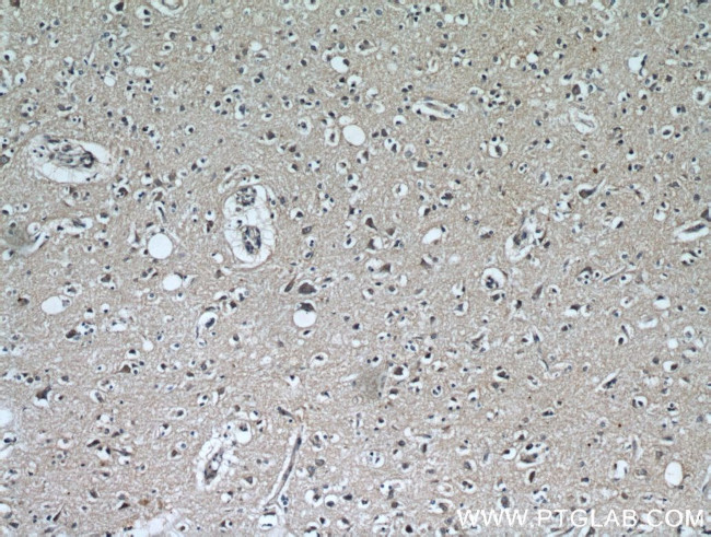 KGA Antibody in Immunohistochemistry (Paraffin) (IHC (P))