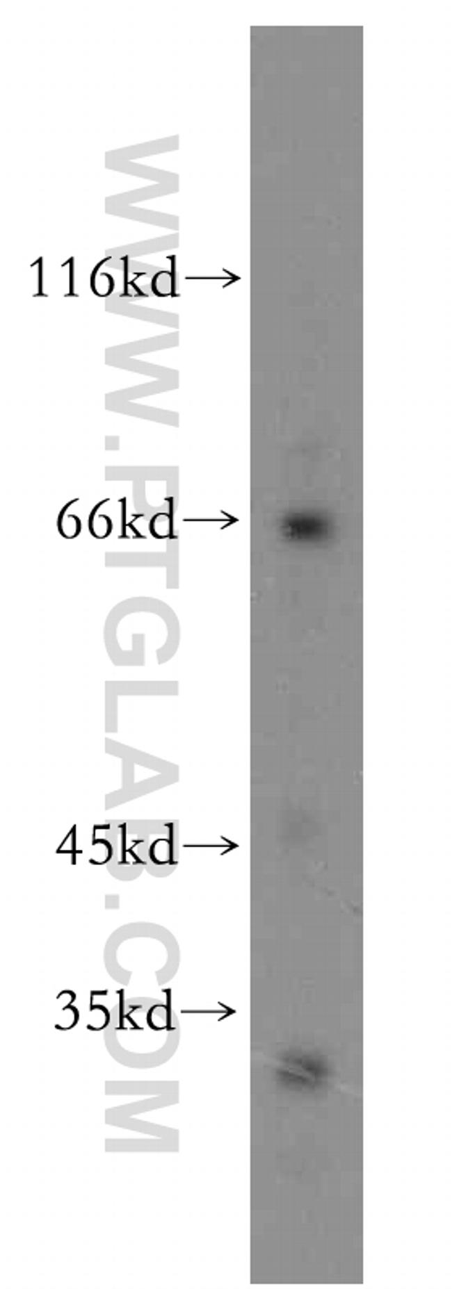 KGA Antibody in Western Blot (WB)