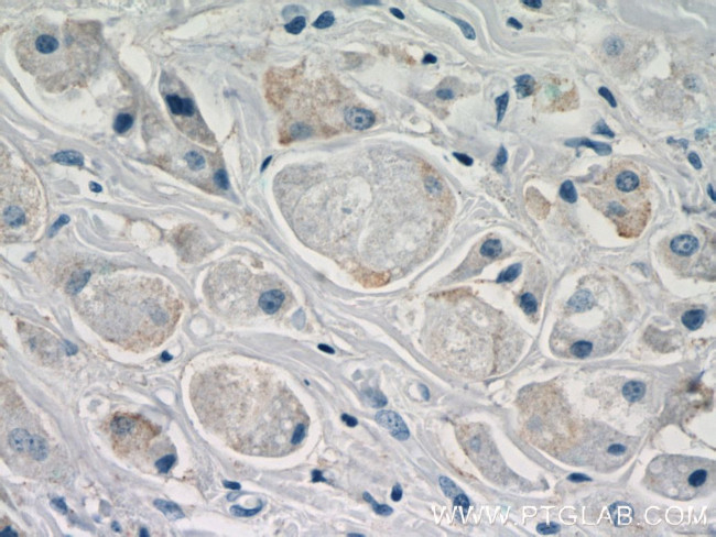 DHRS11 Antibody in Immunohistochemistry (Paraffin) (IHC (P))