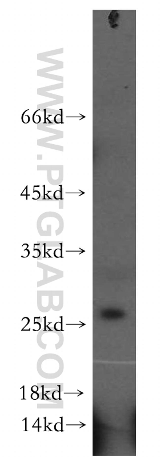 DHRS11 Antibody in Western Blot (WB)