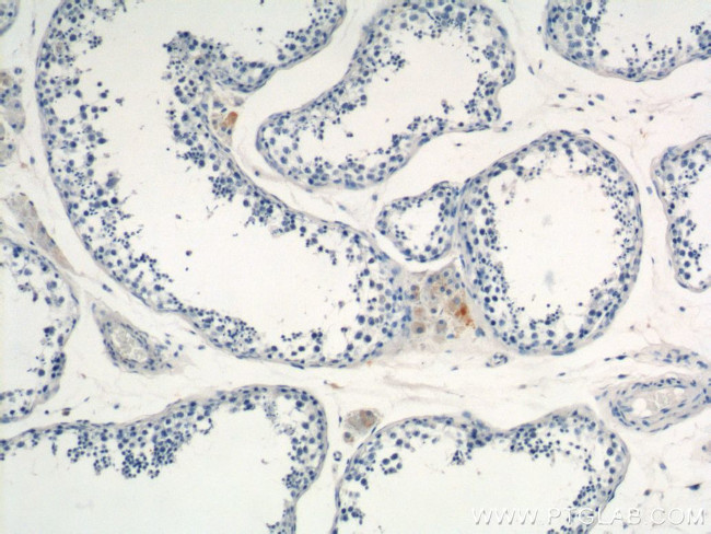 MARK4 Antibody in Immunohistochemistry (Paraffin) (IHC (P))