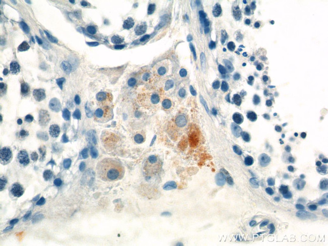 MARK4 Antibody in Immunohistochemistry (Paraffin) (IHC (P))