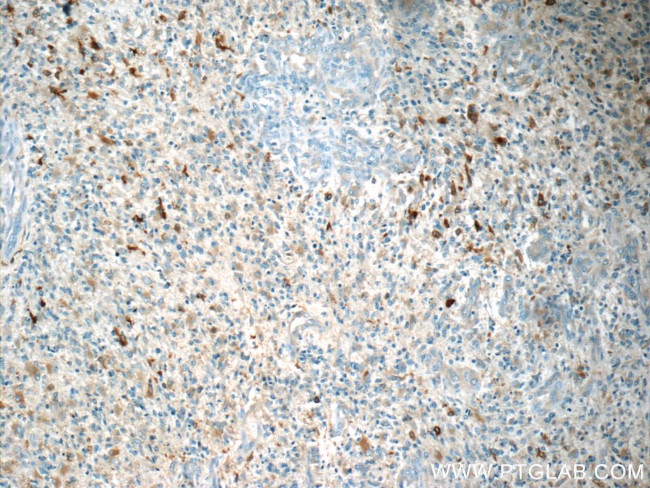 MARK4 Antibody in Immunohistochemistry (Paraffin) (IHC (P))