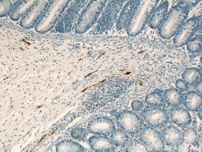 MARK4 Antibody in Immunohistochemistry (Paraffin) (IHC (P))