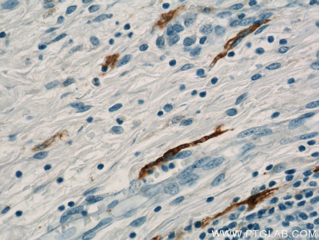 MARK4 Antibody in Immunohistochemistry (Paraffin) (IHC (P))