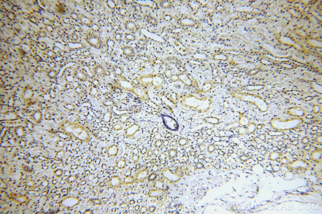 MARK4 Antibody in Immunohistochemistry (Paraffin) (IHC (P))