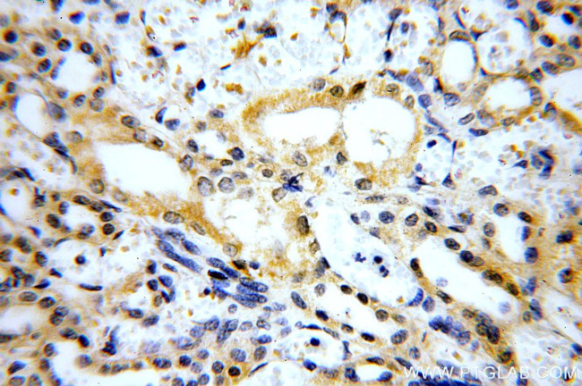 MARK4 Antibody in Immunohistochemistry (Paraffin) (IHC (P))