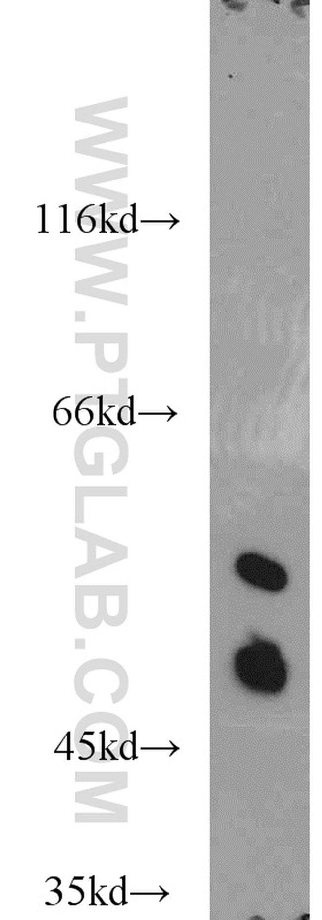 MARK4 Antibody in Western Blot (WB)