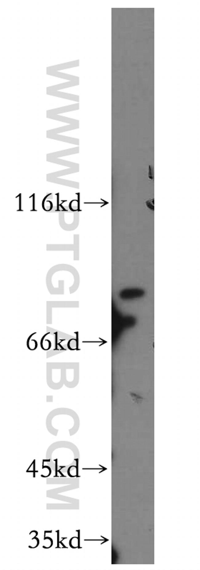 MARK4 Antibody in Western Blot (WB)