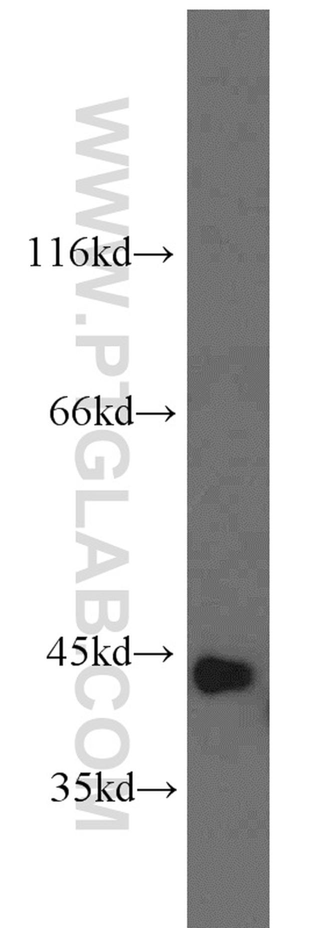 PSAT1 Antibody in Western Blot (WB)