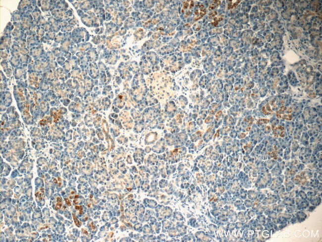 FSTL1 Antibody in Immunohistochemistry (Paraffin) (IHC (P))