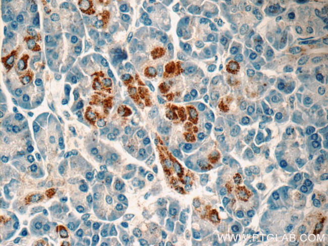 FSTL1 Antibody in Immunohistochemistry (Paraffin) (IHC (P))