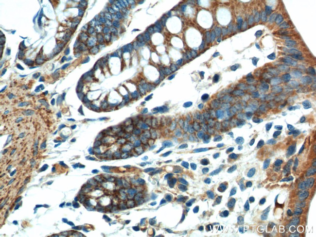 FSTL1 Antibody in Immunohistochemistry (Paraffin) (IHC (P))