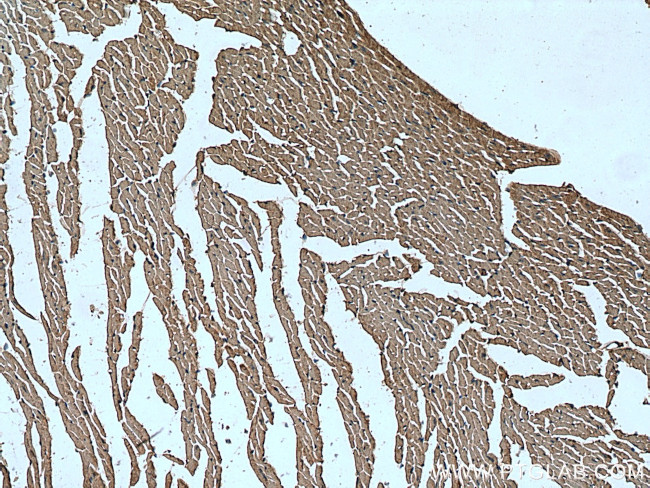 MAPK12 Antibody in Immunohistochemistry (Paraffin) (IHC (P))