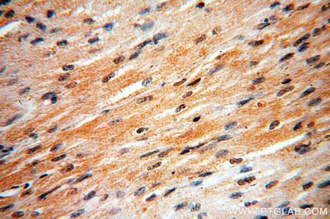 MAPK12 Antibody in Immunohistochemistry (Paraffin) (IHC (P))