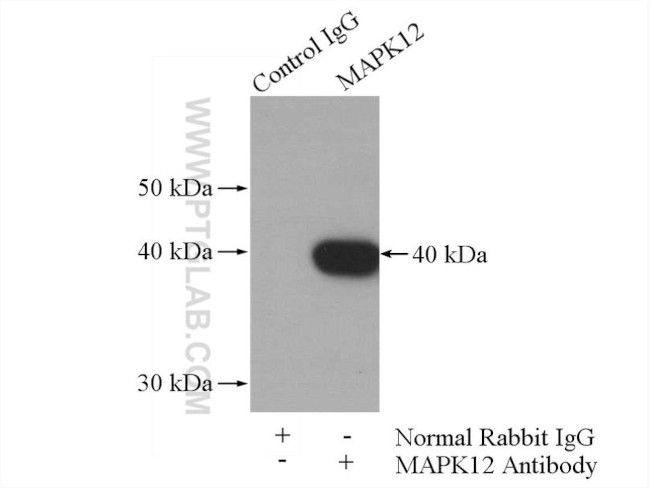 MAPK12 Antibody in Immunoprecipitation (IP)