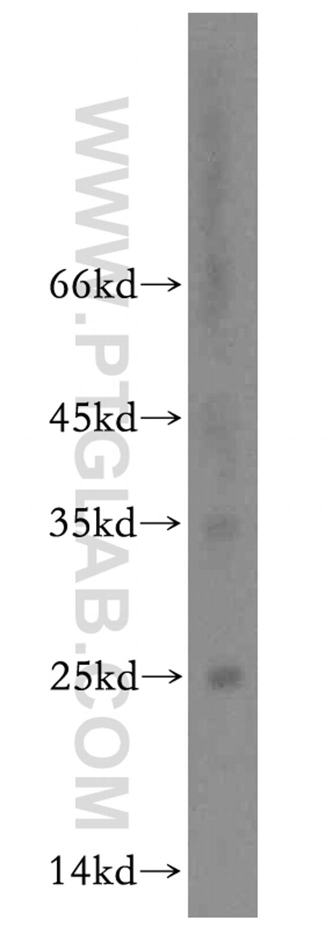 BIN3 Antibody in Western Blot (WB)