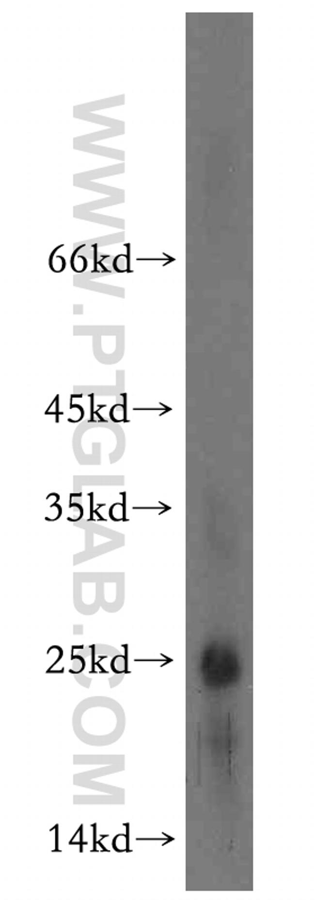 BIN3 Antibody in Western Blot (WB)