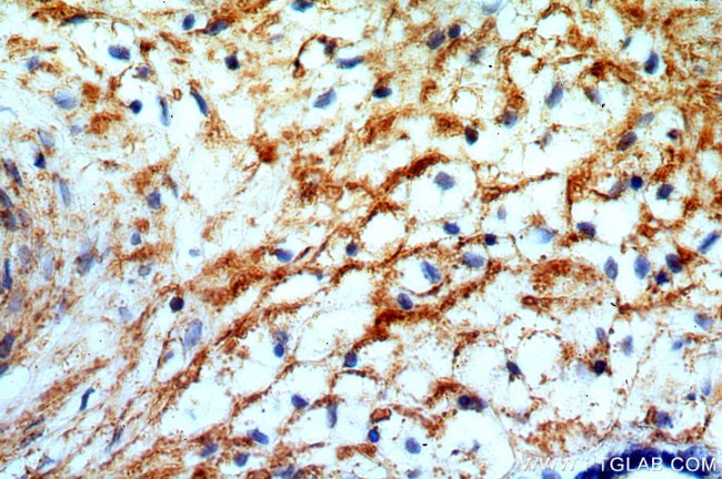 GPR105 Antibody in Immunohistochemistry (Paraffin) (IHC (P))